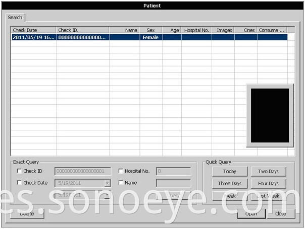 Laptop Ultrasound System With Trolley B